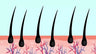 Support For Scalp & Follicles